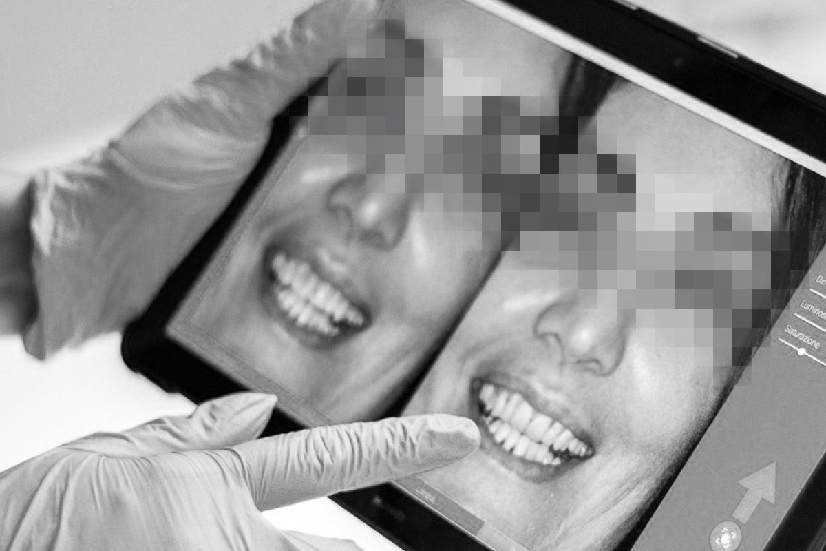 Fotonauk primjena dentalne fotografije